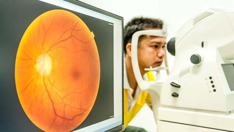why is optomap not covered by insurance