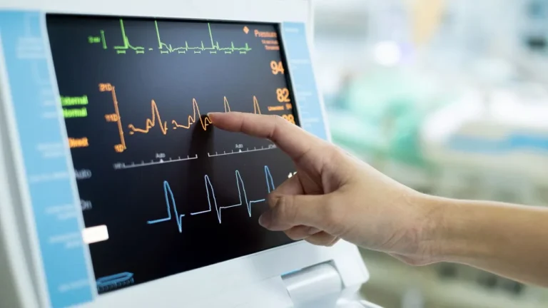 EKG Cost At Urgent Care Without Insurance
