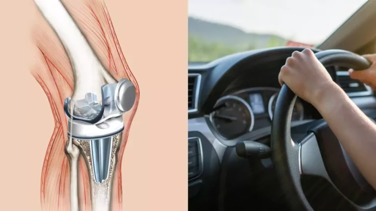 Driving After Knee Replacement Surgery Car Insurance
