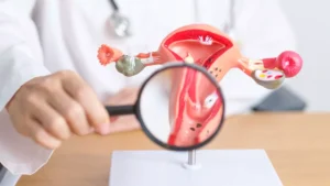 Does Health Insurance Cover Fibroid Removal
